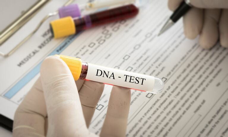 Disadvantages Of Paternity Testing Disadvantages Of Paternity Testing